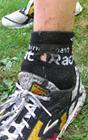 Larry's road rash